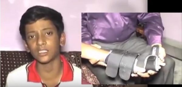 Teacher Hit Student With Wooden Duster Which Caused Fracture In Hand Coz He Was Talking - RVCJ Media