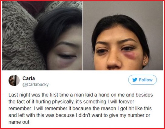 Woman Was Assaulted For Saying ‘No’ & When She Shared Her Story On Twitter, Users Called It Fake - RVCJ Media