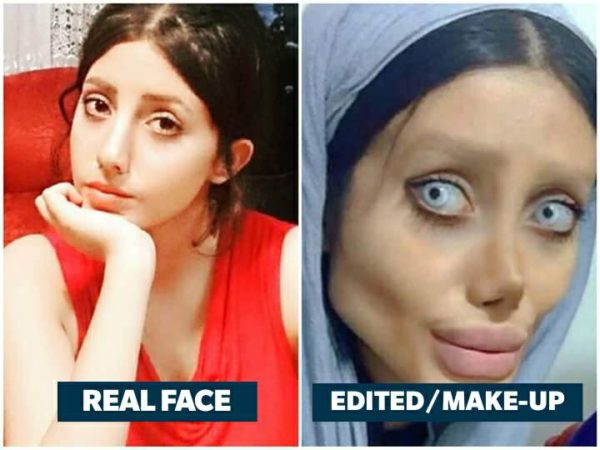 Remember The Girl Who Underwent 50 Surgeries To Look Like Angelina Jolie? Here’s The Truth Behind It - RVCJ Media